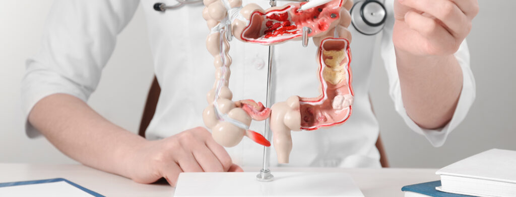 HEMORAGIILE DIGESTIVE – SEMNE DE ALARMĂ EXPLICATE DE DR ALINA PETRIA